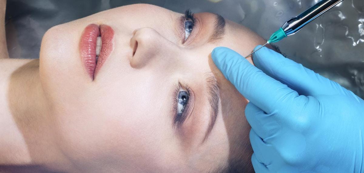 Vertrauen Sie MY AESTHETICS für Botox Nürnberg